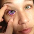 Tatuaggio colorato sulla cornea: ora rischia di perdere la vista
