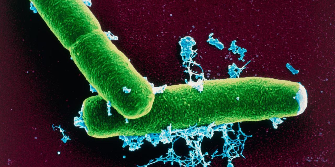 Alle porte di Roma allarme per la morte di bovini e il sospetto contagio di un allevatore. Il bacillo...