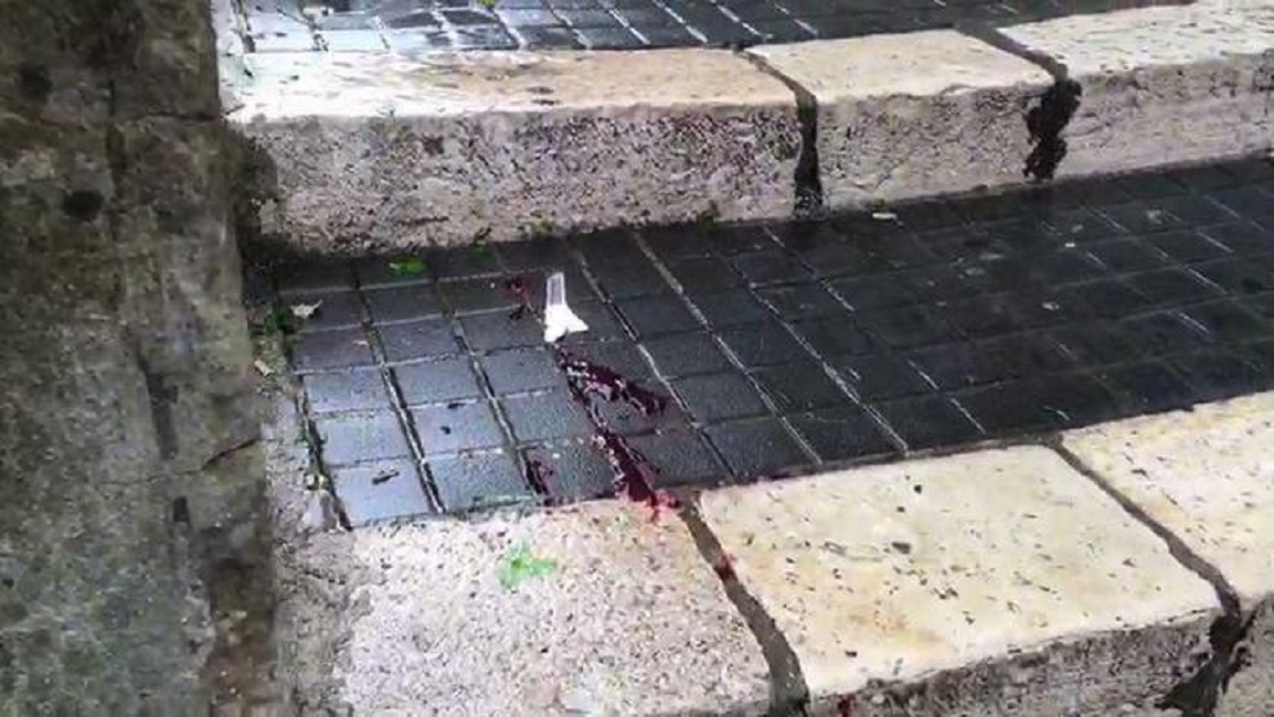 Ischitella, Antonio Di Paola trovato morto: si è ammazzato, aveva sparato in faccia alla figlia della ex05