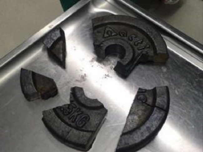 Genitali incastrati nel peso della palestra: intervengono i vigili del fuoco