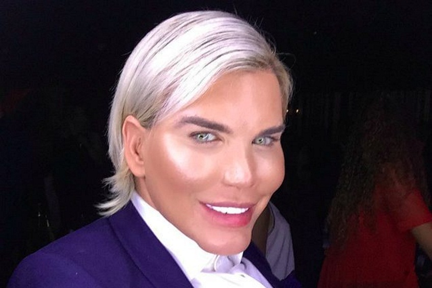 Rodrigo Alves: "Truffato a Marbella, mi hanno rubato 400 euro e rotto due denti"