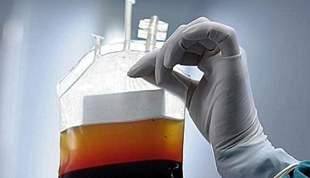 Roma, manca sangue negli ospedali: meno 250 sacche. Per ora ci pensa la banca nazionale