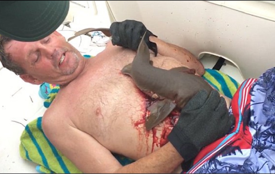 Piccolo squalo resta attaccato alla pancia del pescatore di aragoste