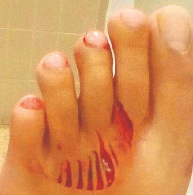 Spagna, ferita mentre fa il bagno in Catalogna FOTO Uno squalo