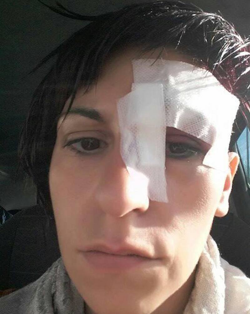 Salerno, aggredita in casa dai topi posta le foto su Facebook