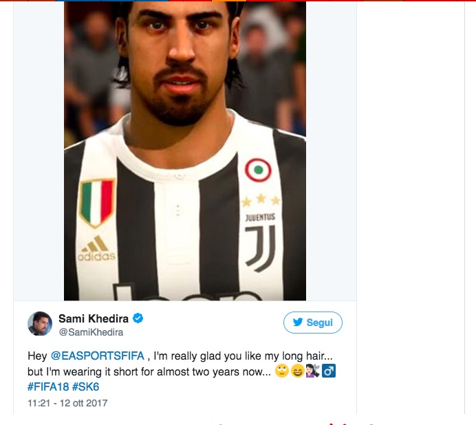 Sami Khedira attacca Fifa: "Sono due anni che non ho i capelli lunghi"