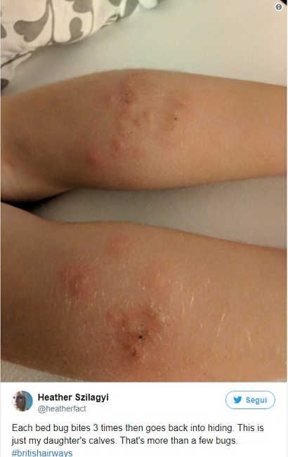 cimici-aereo-british