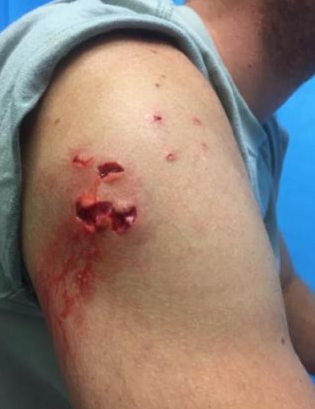 braccio-squalo-tre-metri