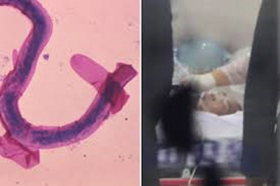 Nord-Corea-disertore-vermi