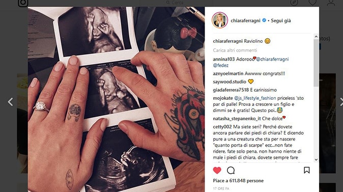 fedez-ferragni-ecografia