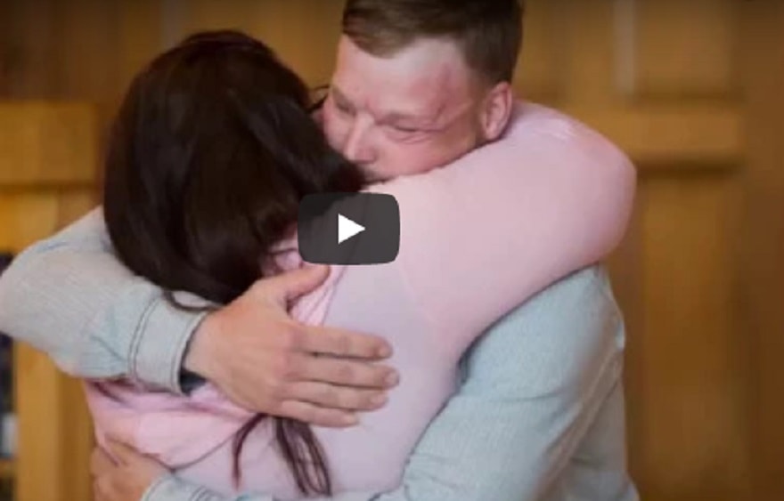 trapianto-faccia-video