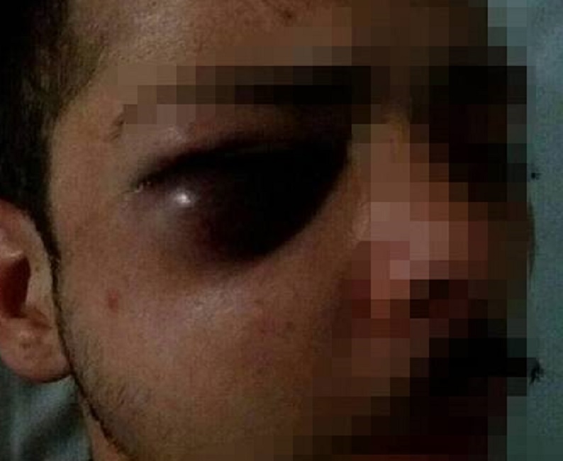 volto-tumefatto-facebook