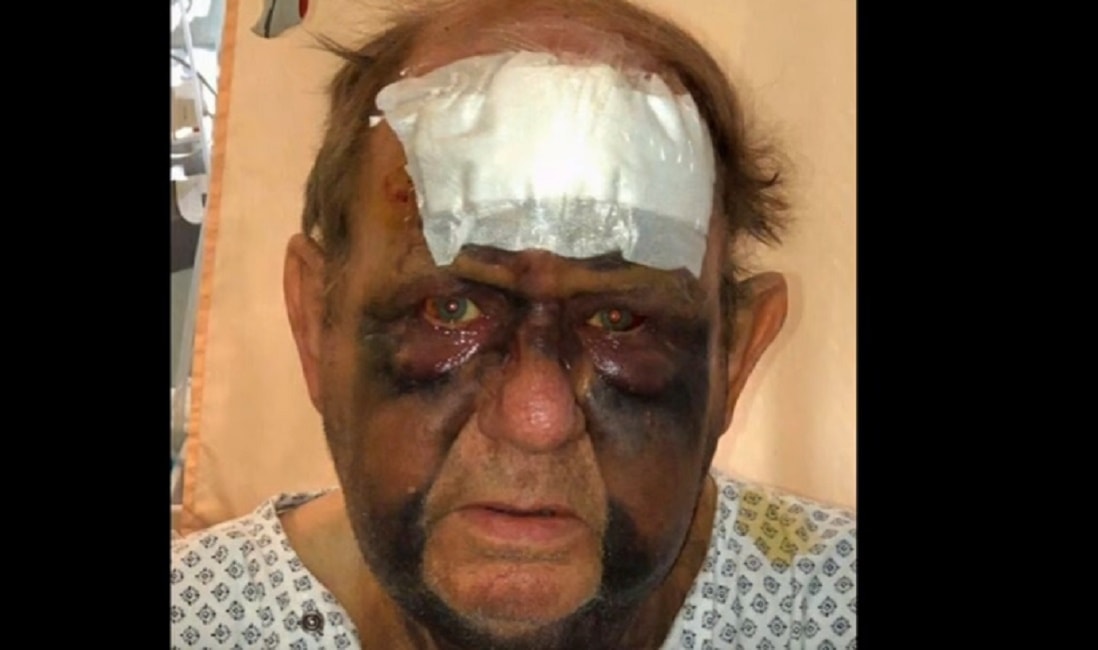 volto-tumefatto-francia-