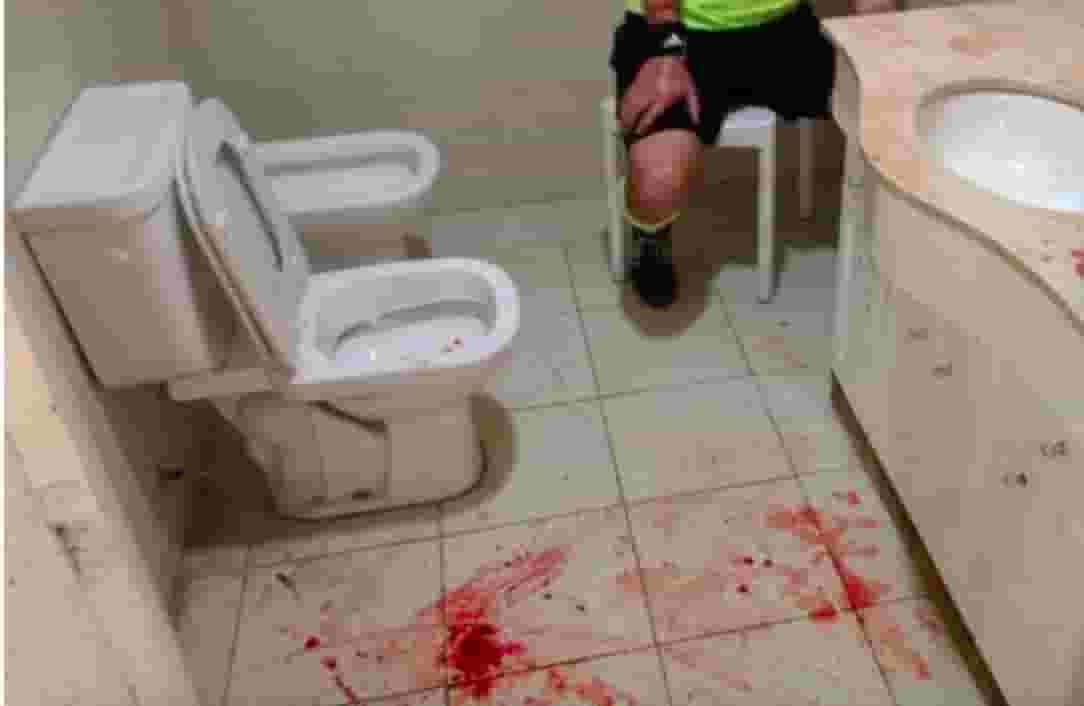 arbitro-pestato-sangue