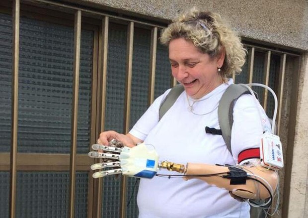 mano-bionica-almerina-mascarello