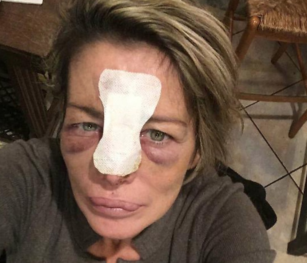 Benedetta-Cimini-buca