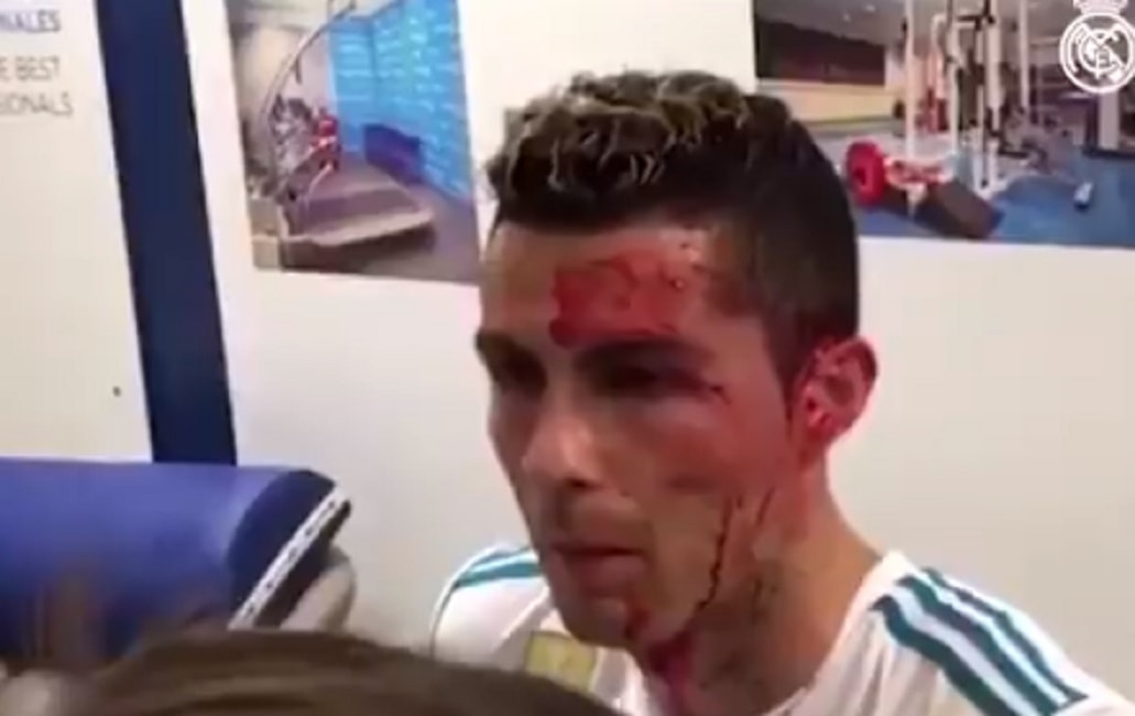 cristiano-ronaldo-viso-insanguinato