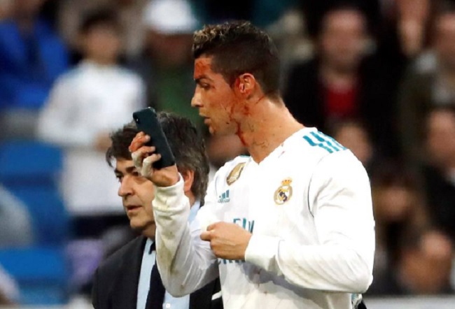 cristiano-ronaldo-sangue-telefonino