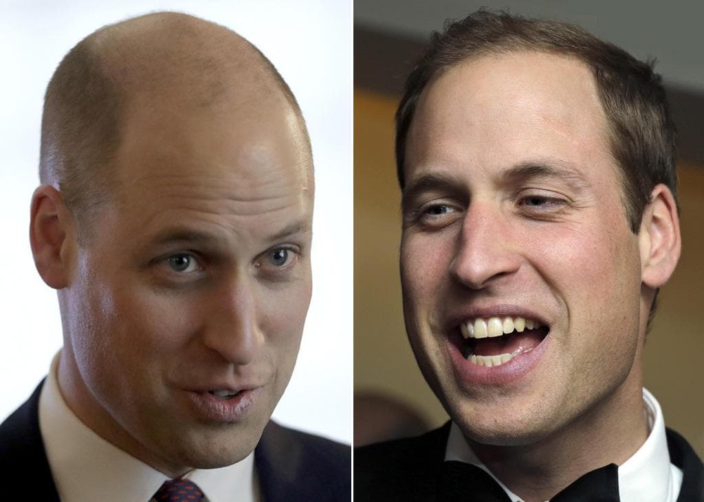 principe-william- foto-ansa