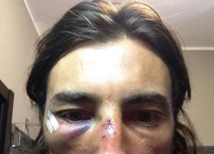 striscia-notizia-brumotti