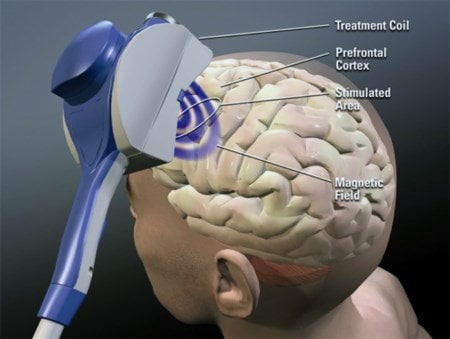 tms-cocaina-lapo-elkann