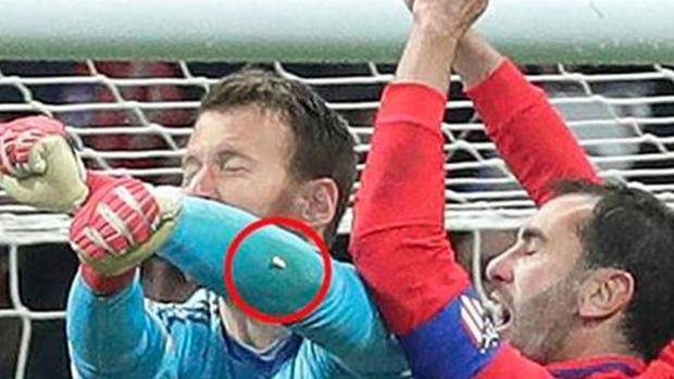 Atletico-Siviglia, uscita scomposta di Neto: a Godin saltano 3 denti