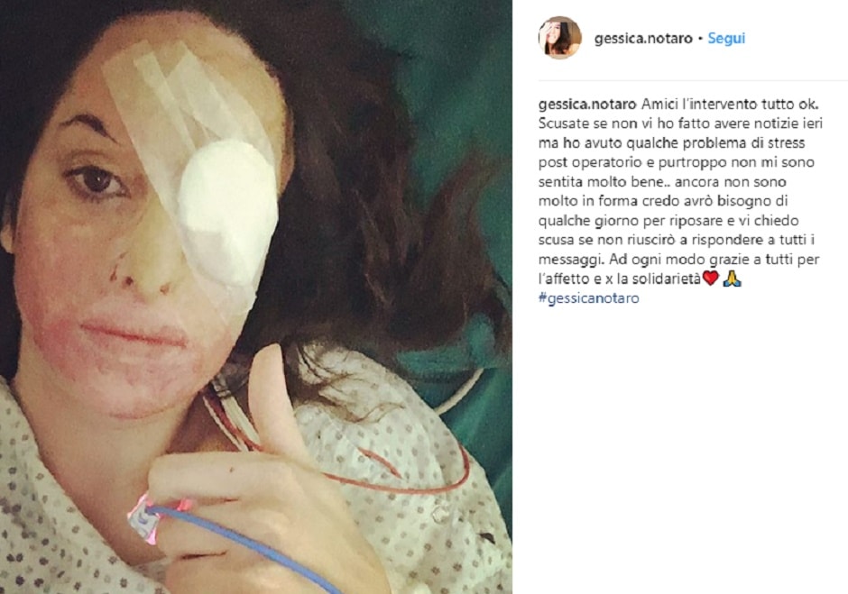 Gessica Notaro con l'occhio bendato