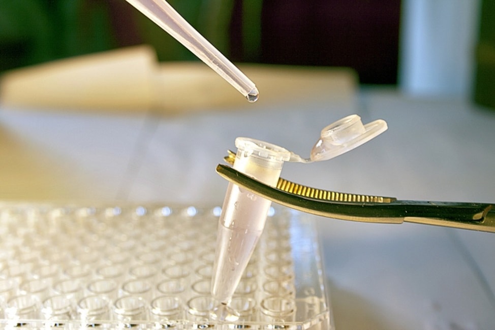 Test genetico per stabilire l'ora esatta della morte: un'arma contro il crimine