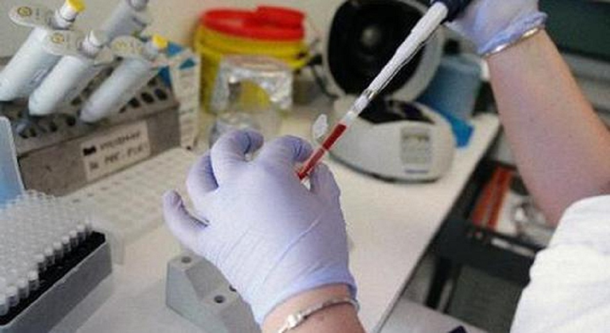 Cagliari, 19enne grave per meningite. Tre giorni fa è morto Giovanni Mandas