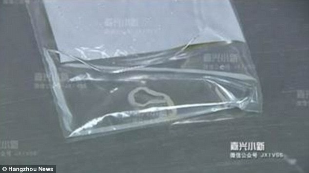 Operata per un nodulo quello che le trovano è incredibile