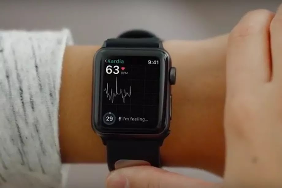 apple watch cuore
