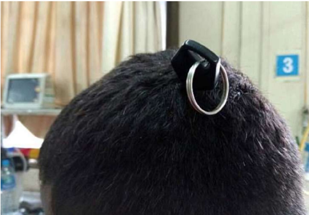 La chiave nella testa