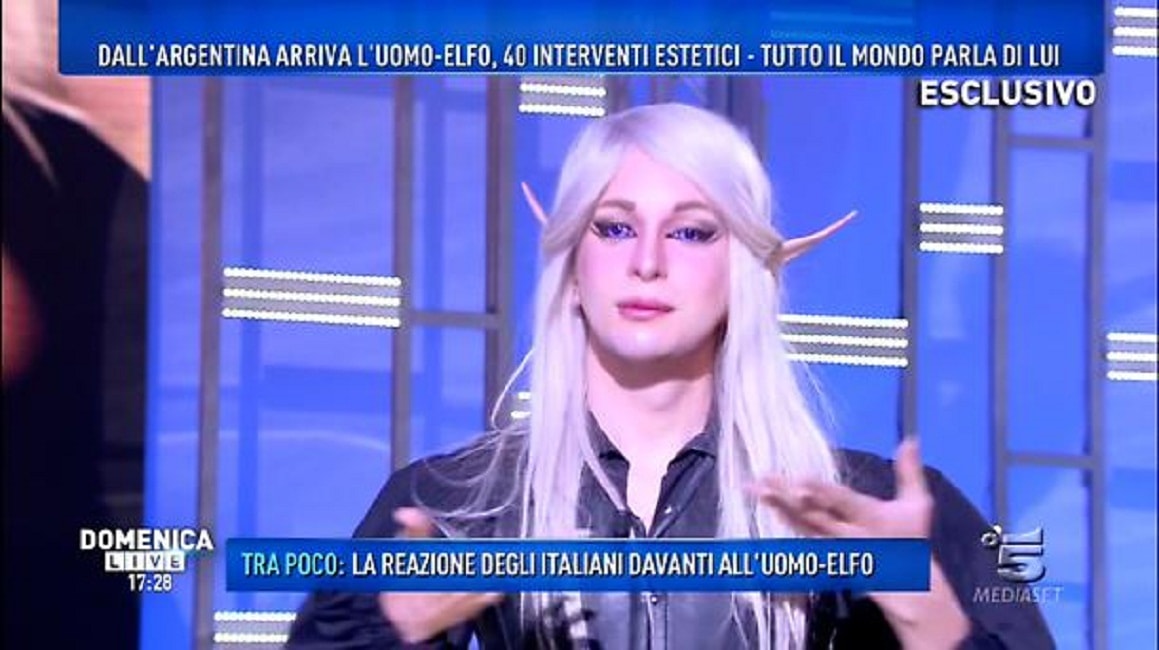 Elfo umano, Luis Padron ospite a Domenica Live