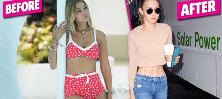 Gigi Hadid, com'è cambiata la modella prima e dopo la malattia alla tiroide