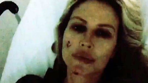Nathalie Caldonazzo in ospedale dopo l'incidente: "Tanta rabbia"