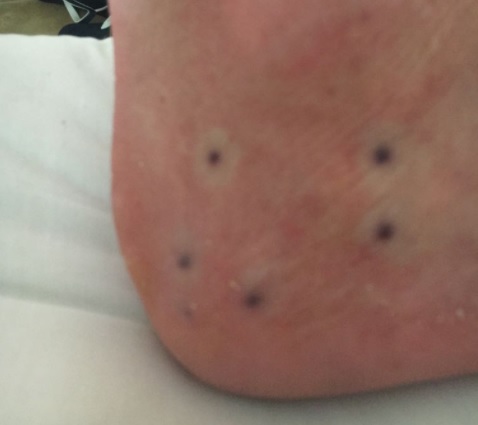 australia oceano ricci