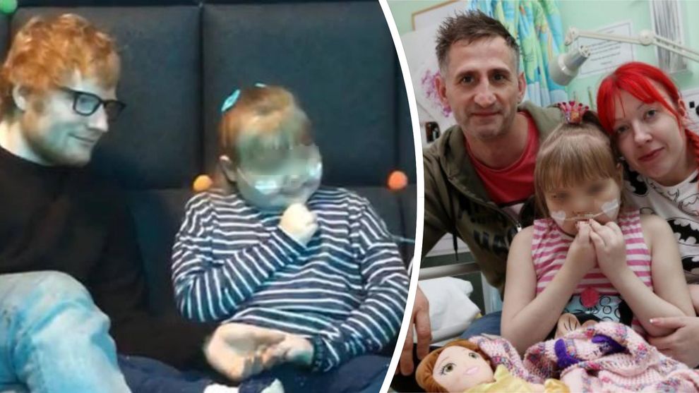 bambina operata calcoli