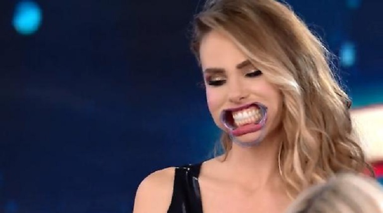 Vuoi scommettere? Ilary Blasi con il divaricatore palatale FOTO