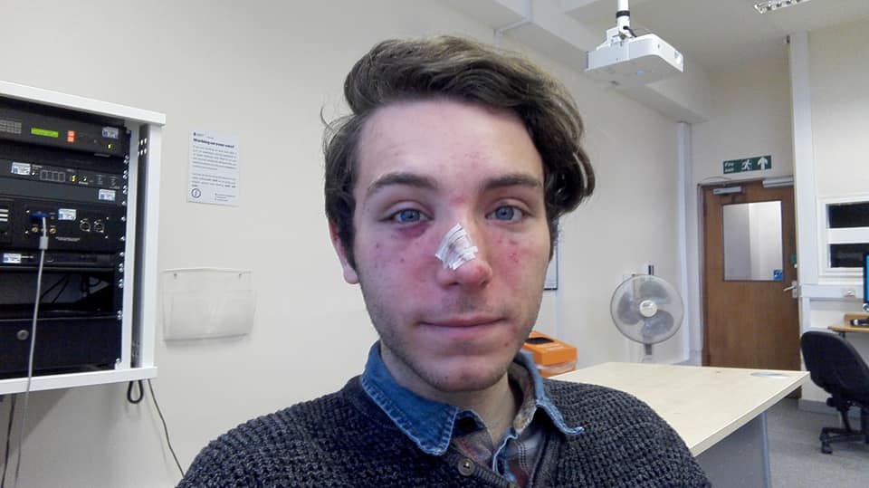 Cambridge: Marzio Fagioli, 21 anni, aggredito da una baby gang