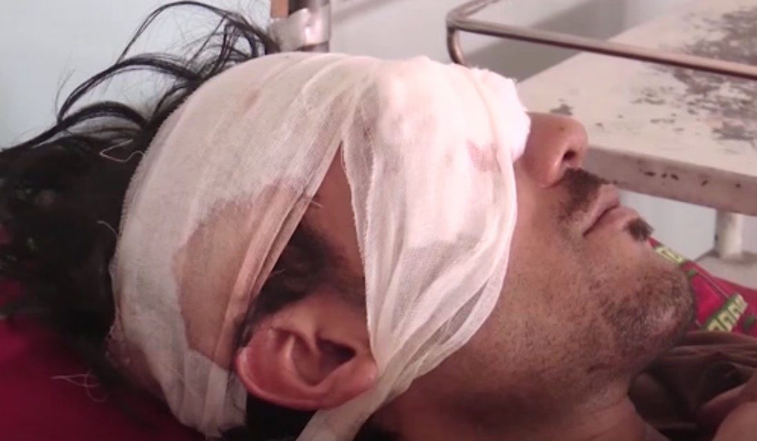 YOUTUBE Pakistan, dice ai genitori di voler sposare la fidanzata: padre e fratelli gli cavano gli occhi con un cucchiaio