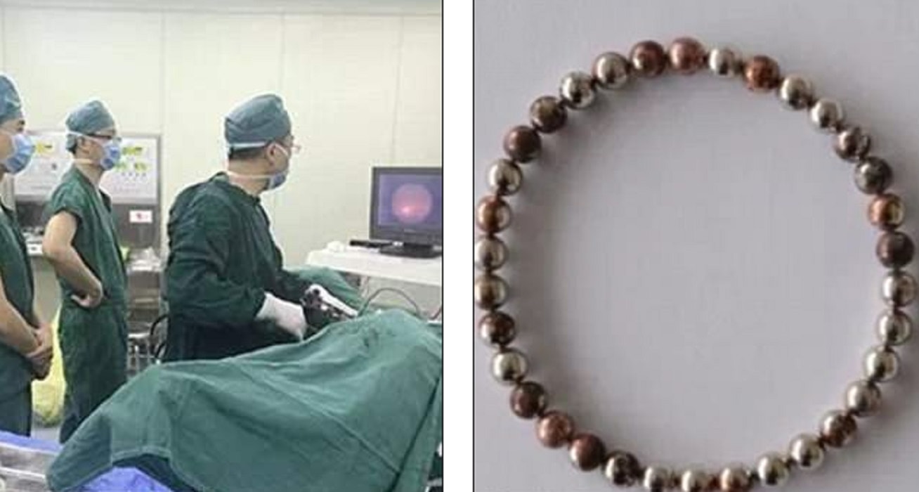 cina, 34 palline nel pene