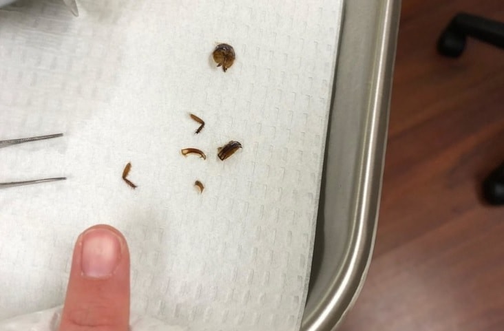 scarafaggio orecchio