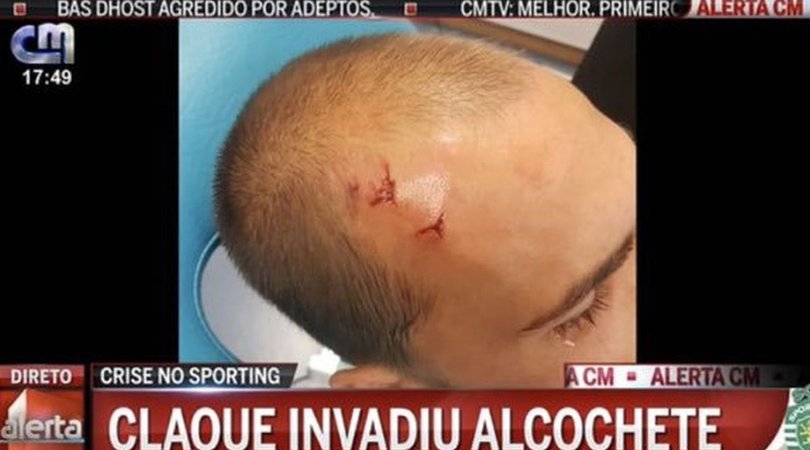 Sporting, calciatori aggrediti: Bas Dost ferito alla testa, paura Rui Patricio
