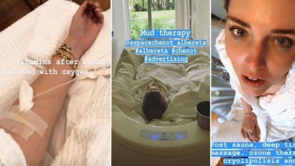 chiara ferragni flebo