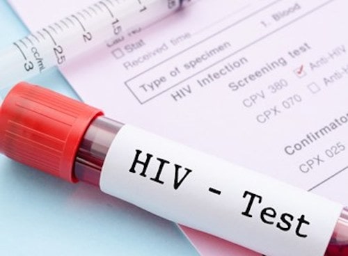 Russia, infezioni Hiv in aumento. Mancano prevenzione e controlli