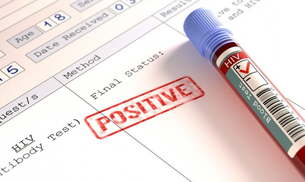 Ancona, con hiv da 11 anni rapporti ma non protetti: arrestato