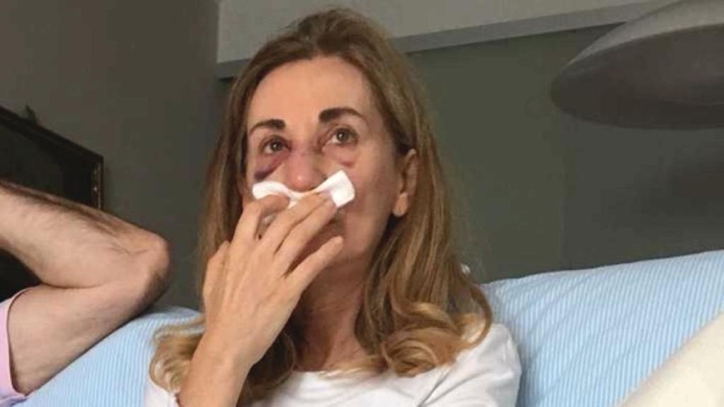 Mamma spaccò setto nasale alla prof, bocciato il figlio. "L'ho picchiata ma mi ha provocato"
