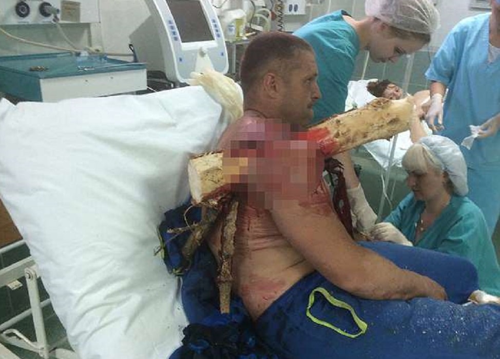 Precipita col parapendio, si ritrova un ramo conficcato nel braccio