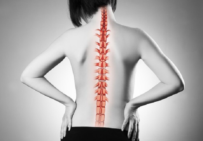 MESA Rail, il nuovo impianto per il trattamento della scoliosi (foto Ansa)