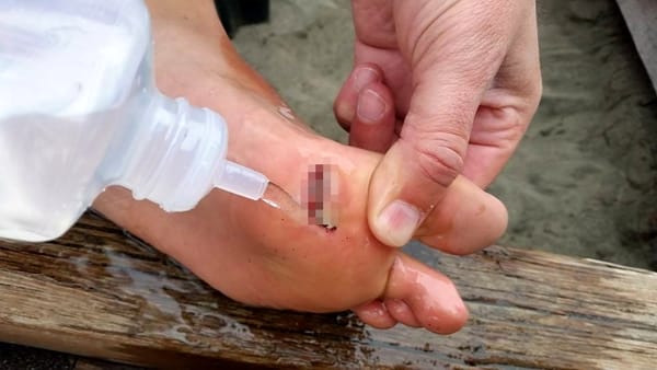 ostia chiodo spiaggia